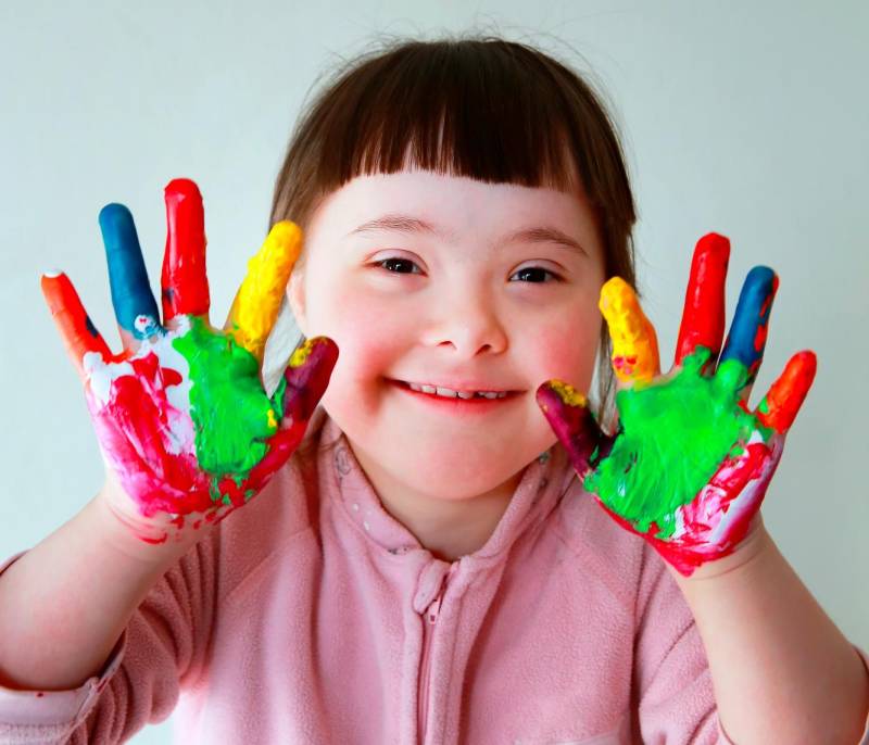 SINDROME DOWN Y SU MANEJO INTEGRAL